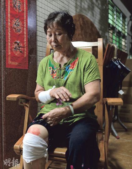 林祖戀妻子楊珍(圖)在丈夫被帶走時追出門外,被推倒在地,手、腿部受輕傷。(明報記者攝) 林祖戀妻子楊珍(圖)在丈夫被帶走時追出門外,被推倒在地,手、腿部受輕傷。(明報記者攝)