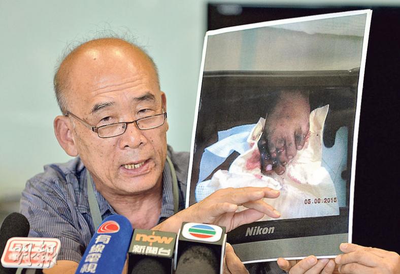 去年3歲男童與家人到海洋公園遊玩,乘扶手電梯時左腳突然被捲入旁板,3隻腳趾近乎被扯斷。男童爺爺蔡先生(圖)展示孫兒受傷的相片,稱孫兒經手術後二趾因壞死要截斷,其餘兩隻腳趾重創變形,現時呈彎曲狀態。(蘇智鑫攝)男童當時穿著圖中的密頭膠鞋,因電梯無自動停止,其家人情急下只好為他拔腳,膠鞋亦遭扯破。(蘇智鑫攝) 去年3歲男童與家人到海洋公園遊玩,乘扶手電梯時左腳突然被捲入旁板,3隻腳趾近乎被扯斷。男童爺爺蔡先生(圖)展示孫兒受傷的相片,稱孫兒經手術後二趾因壞死要截斷,其餘兩隻腳趾重創變形,現時呈彎曲狀態。(蘇智鑫攝)男童當時穿著圖中的密頭膠鞋,因電梯無自動停止,其家人情急下只好為他拔腳,膠鞋亦遭扯破。(蘇智鑫攝)