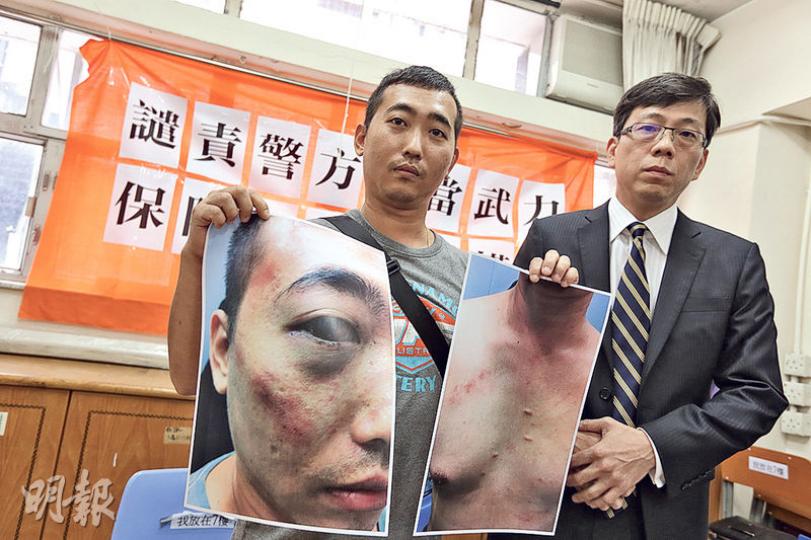 油漆工人梁偉文(左)稱於佔領運動期間被警員無理拘捕致受傷,向警方成功索償,律政司曾要求簽署保密協議但被他拒絕。右為其律師林洋鋐。(馮凱鍵攝) 油漆工人梁偉文(左)稱於佔領運動期間被警員無理拘捕致受傷,向警方成功索償,律政司曾要求簽署保密協議但被他拒絕。右為其律師林洋鋐。(馮凱鍵攝)
