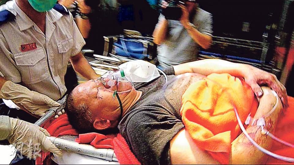鋸樹期間失足跌下、被防盜鐵枝貫穿右膝的男戶主(圖),「連人帶鐵枝」被送院救治。(衛永康攝) 鋸樹期間失足跌下、被防盜鐵枝貫穿右膝的男戶主(圖),「連人帶鐵枝」被送院救治。(衛永康攝)