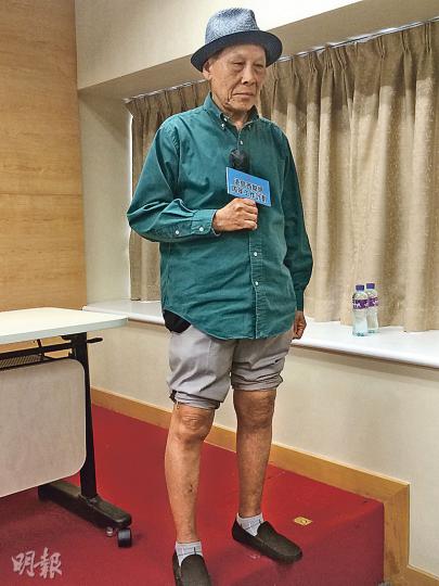 65歲的黃伯(圖)因關節退化令雙膝變形疼痛,手術前拄拐杖走路不能多於5分鐘,去年11月置換左膝關節後,即日已下牀走路,左膝不再痛,現時其右膝仍有變形,計劃今年10月再做手術。(梁杏怡攝) 65歲的黃伯(圖)因關節退化令雙膝變形疼痛,手術前拄拐杖走路不能多於5分鐘,去年11月置換左膝關節後,即日已下牀走路,左膝不再痛,現時其右膝仍有變形,計劃今年10月再做手術。(梁杏怡攝)