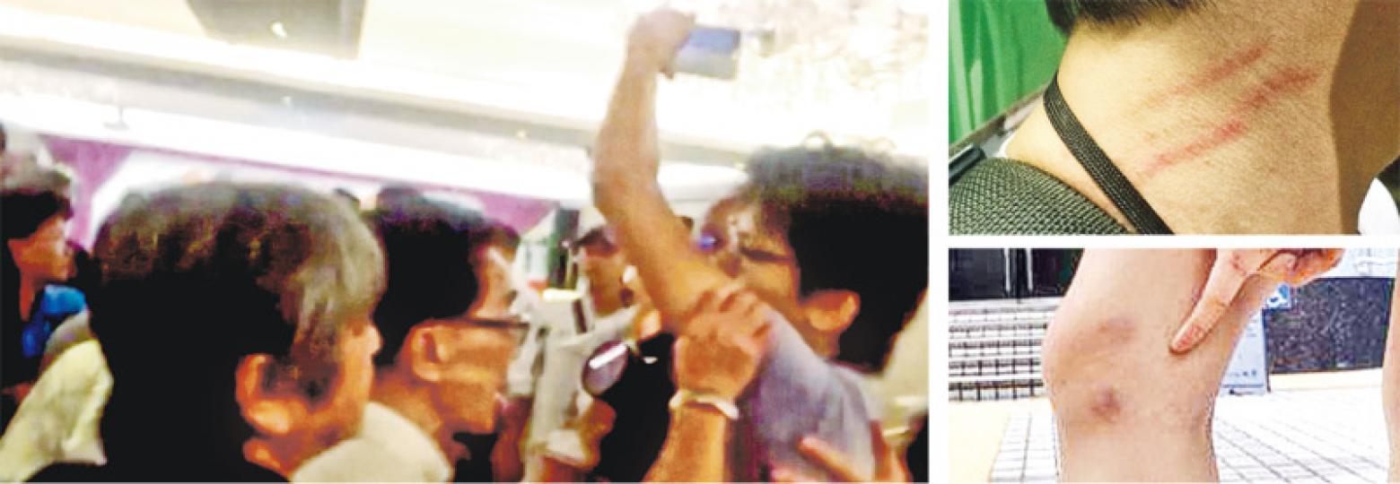 本報記者前晚在宴會現場舉起手機拍攝,被多名賓客包圍和推撞(左圖),手機更被奪去,至今仍未尋回。該名記者頸和手部受傷(右上圖),另一名在場的記者亦有多處瘀傷(右下圖)。(明報記者攝)重案組警員昨到尖沙嘴德興火鍋酒家,就前晚記者被包圍推撞和受傷展開調查。(郭慶輝攝) 本報記者前晚在宴會現場舉起手機拍攝,被多名賓客包圍和推撞(左圖),手機更被奪去,至今仍未尋回。該名記者頸和手部受傷(右上圖),另一名在場的記者亦有多處瘀傷(右下圖)。(明報記者攝)重案組警員昨到尖沙嘴德興火鍋酒家,就前晚記者被包圍推撞和受傷展開調查。(郭慶輝攝)