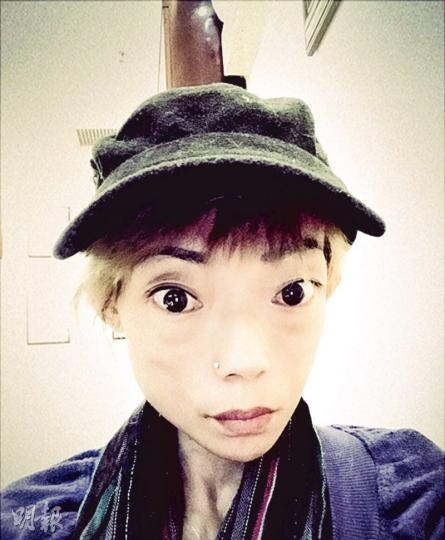 郭永淳前妻伍智恒上載照片指自己目前只有50多磅。（微博圖片）