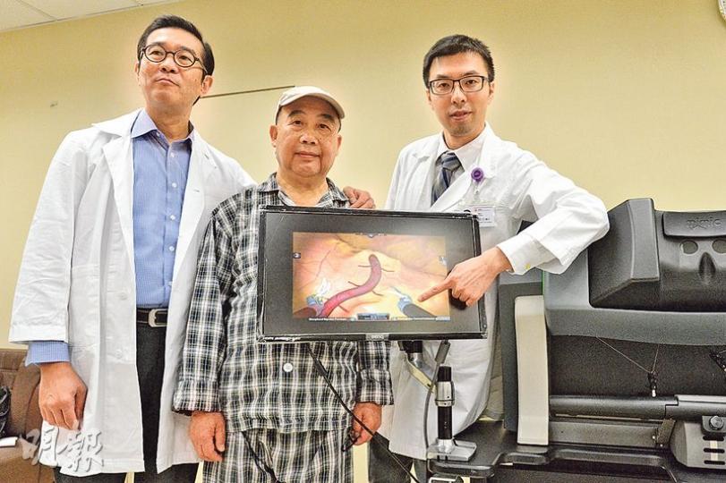 瑪麗醫院引用機械臂輔助進行心臟二尖瓣及心漏修補手術,醫院心胸外科顧問醫生陳泰良(右)表示,手術時醫生透過3D顯示屏觀察胸腔結構。圖左為瑪麗醫院心胸外科部門主管區永谷、中為曾接受機械臂手術的66歲病人方先生,在手術後3天已經可自行落牀。(黃志東攝) 瑪麗醫院引用機械臂輔助進行心臟二尖瓣及心漏修補手術,醫院心胸外科顧問醫生陳泰良(右)表示,手術時醫生透過3D顯示屏觀察胸腔結構。圖左為瑪麗醫院心胸外科部門主管區永谷、中為曾接受機械臂手術的66歲病人方先生,在手術後3天已經可自行落牀。(黃志東攝)