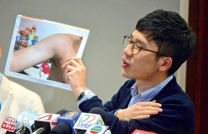 羅冠聰(圖)昨日在黃之鋒、朱凱廸以及姚松炎等一同赴台的人士陪同下,召開記者會講述前晚於香港機場受襲一事。羅在會上展示多張其傷勢的相片,斥示威者以暴力方法打壓異己,根本稱不上是示威者,只是「義和團」。羅強調,任何人都不應用暴力解決問題,這是多元開放文明社會的共識。(蘇智鑫攝) 羅冠聰(圖)昨日在黃之鋒、朱凱廸以及姚松炎等一同赴台的人士陪同下,召開記者會講述前晚於香港機場受襲一事。羅在會上展示多張其傷勢的相片,斥示威者以暴力方法打壓異己,根本稱不上是示威者,只是「義和團」。羅強調,任何人都不應用暴力解決問題,這是多元開放文明社會的共識。(蘇智鑫攝)