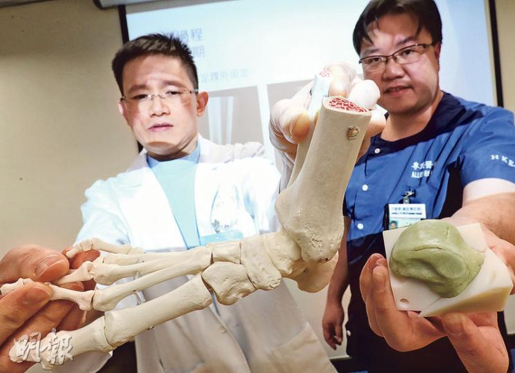 東區醫院骨科團隊首次用3D打印技術製作植入手術所需的假體,圖為該院骨科顧問醫生趙善揚(左)及一級義肢矯形師尹建華(右),尹手持的是早前植入傷者足踝的骨水泥人工距骨。(李紹昌攝) 東區醫院骨科團隊首次用3D打印技術製作植入手術所需的假體,圖為該院骨科顧問醫生趙善揚(左)及一級義肢矯形師尹建華(右),尹手持的是早前植入傷者足踝的骨水泥人工距骨。(李紹昌攝)