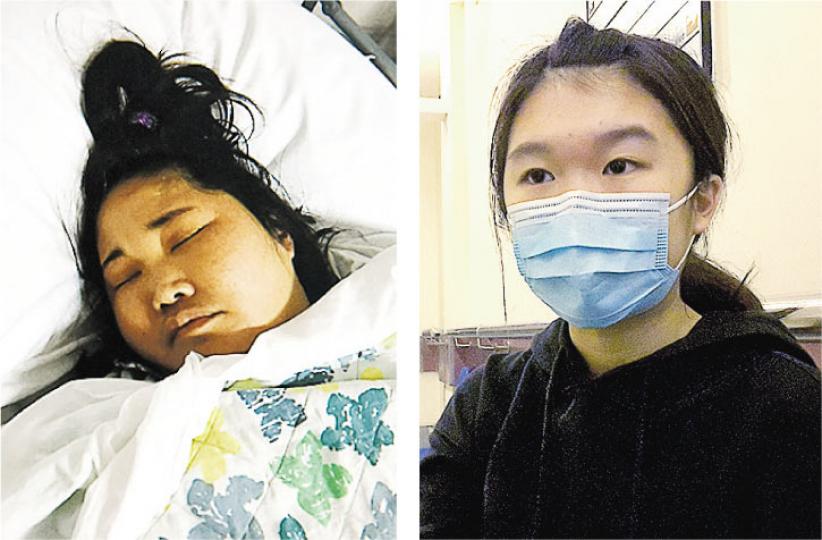 43歲的鄧桂思(左圖)患急性肝衰竭需換肝保命,現於瑪麗醫院留醫,其女兒(右圖)3個月後才滿18歲,不符合捐肝要求。女兒希望當局能行使酌情權,給母親多一個換肝的機會。(鍾炳然攝) 43歲的鄧桂思(左圖)患急性肝衰竭需換肝保命,現於瑪麗醫院留醫,其女兒(右圖)3個月後才滿18歲,不符合捐肝要求。女兒希望當局能行使酌情權,給母親多一個換肝的機會。(鍾炳然攝)