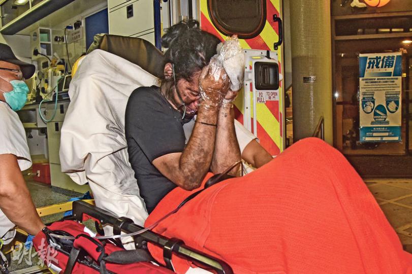 外籍女住客手腳燒傷,面部熏黑,救護車送院治理後情况危殆。(蔡方山攝) 外籍女住客手腳燒傷,面部熏黑,救護車送院治理後情况危殆。(蔡方山攝)