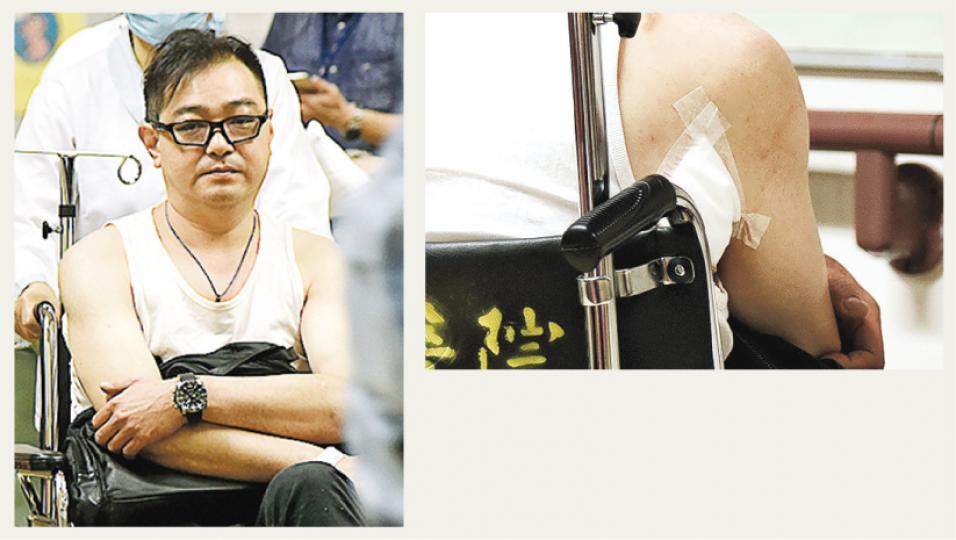 因喝止狂徒襲擊老翁而遭刺傷的林姓事主(左圖),一度尾隨跟蹤疑犯及報警,協助拘捕疑犯;案件中林的右腋被剪刀刺傷(右圖),幸傷勢不嚴重,送院治理後未有大礙。(鍾炳然攝) 因喝止狂徒襲擊老翁而遭刺傷的林姓事主(左圖),一度尾隨跟蹤疑犯及報警,協助拘捕疑犯;案件中林的右腋被剪刀刺傷(右圖),幸傷勢不嚴重,送院治理後未有大礙。(鍾炳然攝)