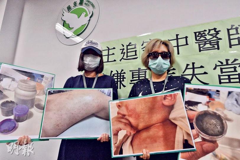 家長黃太(左)及鄧太(右)的半歲男嬰均曾使用註冊中醫彭惠明所處方的藥膏治療濕疹,鄧太因發現兒子皮膚變白而對藥膏成分起疑,衛生署化驗發現該藥膏樣本含皮質類固醇。兩人促請衛生署徹查,另稱會諮詢法律意見,強調須追究責任。(馮凱鍵攝) 家長黃太(左)及鄧太(右)的半歲男嬰均曾使用註冊中醫彭惠明所處方的藥膏治療濕疹,鄧太因發現兒子皮膚變白而對藥膏成分起疑,衛生署化驗發現該藥膏樣本含皮質類固醇。兩人促請衛生署徹查,另稱會諮詢法律意見,強調須追究責任。(馮凱鍵攝)
