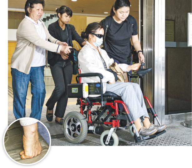 因接受涉案療程導致需截去一雙小腿及右手4隻手指(小圖)的王靜波(前),現時雙腿相信是裝上義肢,要靠輪椅出入。她表示事發後記憶力及聽力衰退,原本任職小學教師的她,事後不獲學校續約。(楊柏賢攝) 因接受涉案療程導致需截去一雙小腿及右手4隻手指(小圖)的王靜波(前),現時雙腿相信是裝上義肢,要靠輪椅出入。她表示事發後記憶力及聽力衰退,原本任職小學教師的她,事後不獲學校續約。(楊柏賢攝)