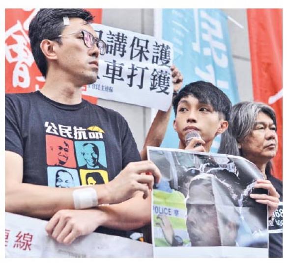 社民連主席吳文遠(左)及成員陳皓桓(中)稱被警員襲擊,昨到灣仔警察總部報案,吳額頭右上角、右手腕位置及右手中指等均貼有膠布。(蘇智鑫攝) 社民連主席吳文遠(左)及成員陳皓桓(中)稱被警員襲擊,昨到灣仔警察總部報案,吳額頭右上角、右手腕位置及右手中指等均貼有膠布。(蘇智鑫攝)