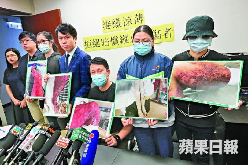 ■多名傷者及其家屬於記者會展示意外後傷勢。
