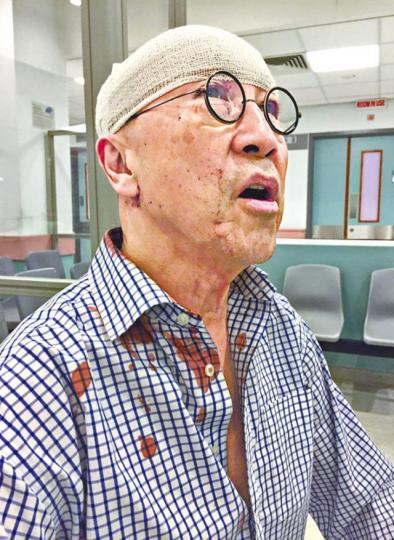 ■張之珏在扶手電梯上向後翻,即送往醫院接受治療。互聯網圖片■張之珏頭破血流需縫四針,衣領更留有血迹。■張之珏日前出席汪明荃學位頒授典禮,疑似在當晚發生意外。互聯網圖片■張之珏前晚頭部包着紗布仍繼續主持D100節目,非常專業。互聯網圖片張之珏(左) ■張之珏在扶手電梯上向後翻,即送往醫院接受治療。互聯網圖片■張之珏頭破血流需縫四針,衣領更留有血迹。■張之珏日前出席汪明荃學位頒授典禮,疑似在當晚發生意外。互聯網圖片■張之珏前晚頭部包着紗布仍繼續主持D100節目,非常專業。互聯網圖片張之珏(左)