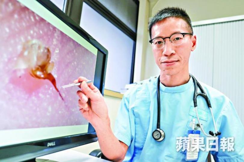 ■馮顯達表示,傷者應盡快拔走毒針,防毒液擴散。許頌明攝 ■馮顯達表示,傷者應盡快拔走毒針,防毒液擴散。許頌明攝