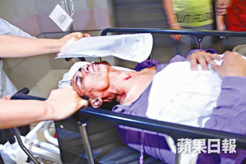 ■客貨車司機頭部受傷送院。翁鈺輝攝 ■客貨車司機頭部受傷送院。翁鈺輝攝