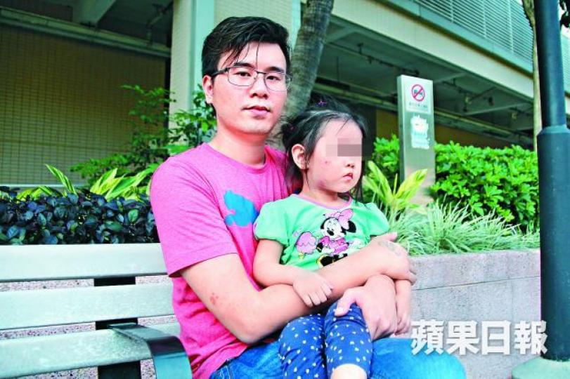 ■王先生心疼愛女受傷,指咬人童父母有責任道歉。李晟謙攝 ■王先生心疼愛女受傷,指咬人童父母有責任道歉。李晟謙攝