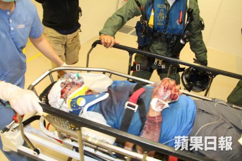 ■墮澗致頭破血流的男事主經直升機送院救治。 ■墮澗致頭破血流的男事主經直升機送院救治。