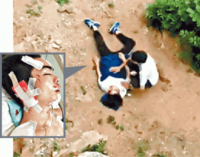 ■事主在別墅墮下約6米高斜坡,頭部重傷(左圖)。■意外後別墅地板出現一個方形大窿。受訪者提供圖片 ■事主在別墅墮下約6米高斜坡,頭部重傷(左圖)。■意外後別墅地板出現一個方形大窿。受訪者提供圖片