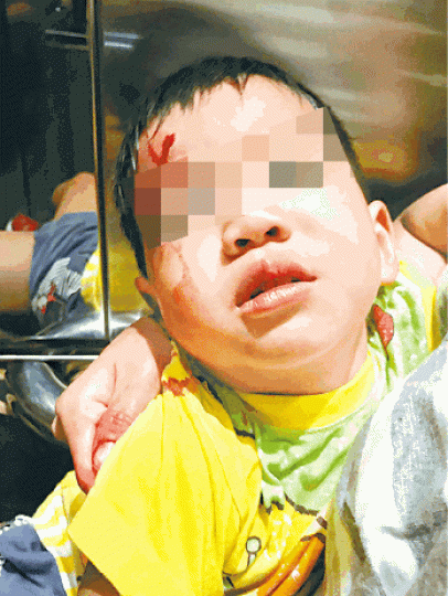 ■首案發生於8月31日,一名兩歲男童於明德邨被人以氣槍射擊前額險盲。 ■首案發生於8月31日,一名兩歲男童於明德邨被人以氣槍射擊前額險盲。