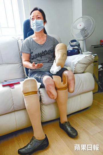 ■王靜波為保命,截去右手拇指至無名指及一雙小腿。資料圖片 ■王靜波為保命,截去右手拇指至無名指及一雙小腿。資料圖片