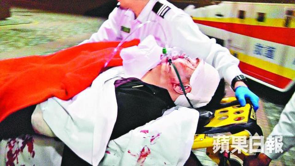 ■男東主頭部及手腳受傷,目前情況嚴重。資料圖片
■男東主頭部及手腳受傷,目前情況嚴重。資料圖片
