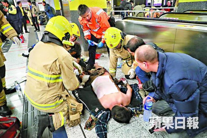 ■港鐵縱火案當日,鄭澤言全身多處燒傷。 ■港鐵縱火案當日,鄭澤言全身多處燒傷。