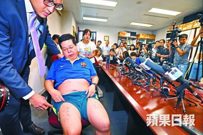 ■林子健曾報稱大腿遭人用釘書機打釘,並開記者會交代事件。
■林子健曾報稱大腿遭人用釘書機打釘,並開記者會交代事件。