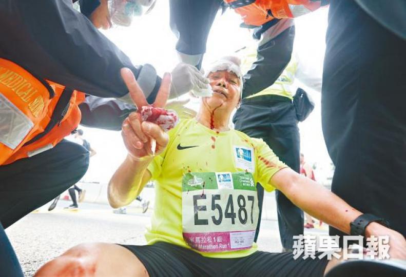 ■一名選手在西隧口意外跌傷頭部,血流披面。王子俊攝 ■一名選手在西隧口意外跌傷頭部,血流披面。王子俊攝