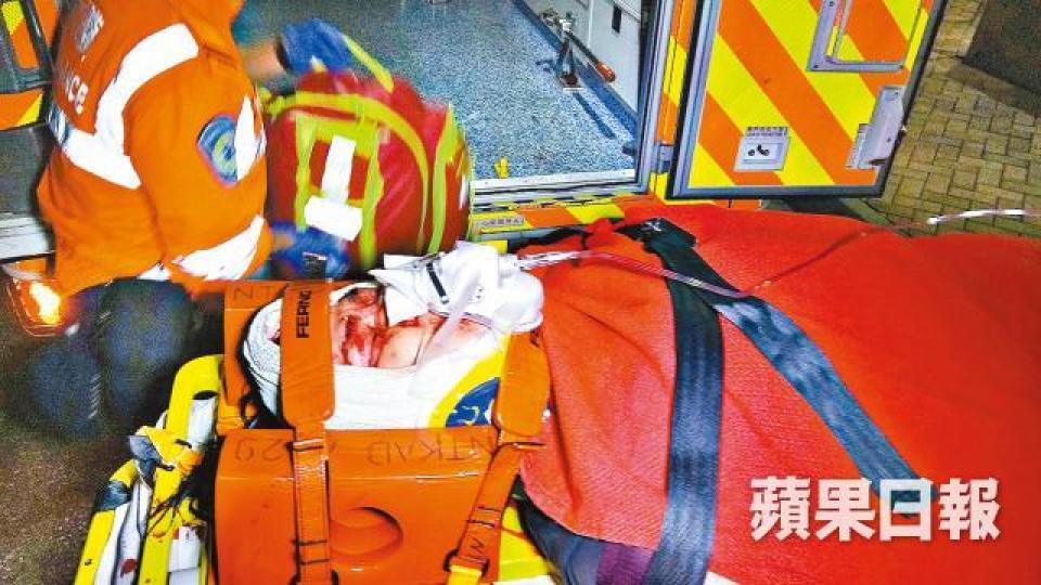 ■兒子撼傷額頭滿面血,送院治理。
■兒子撼傷額頭滿面血,送院治理。