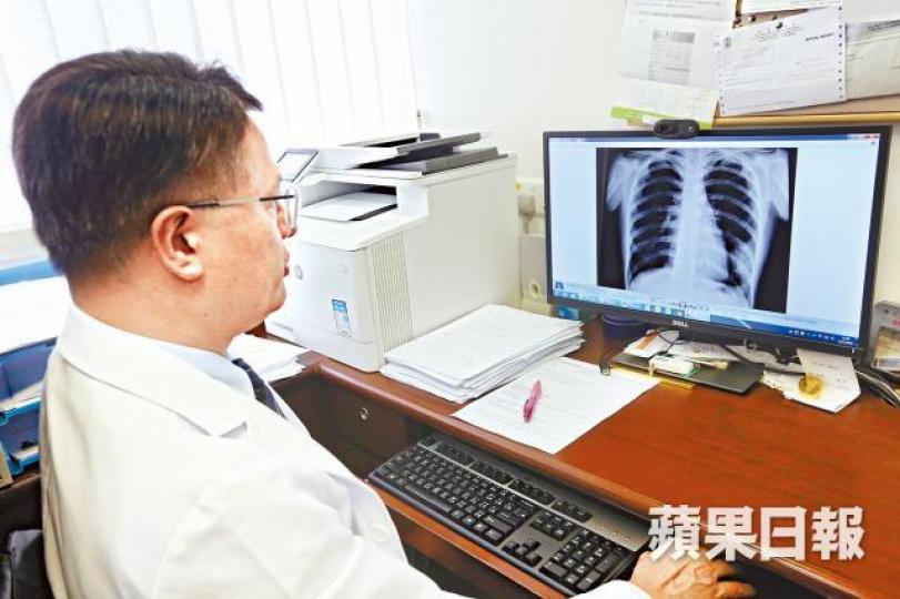 ■沙士爆發初期，許樹昌一晚曾看40張同事的肺片。