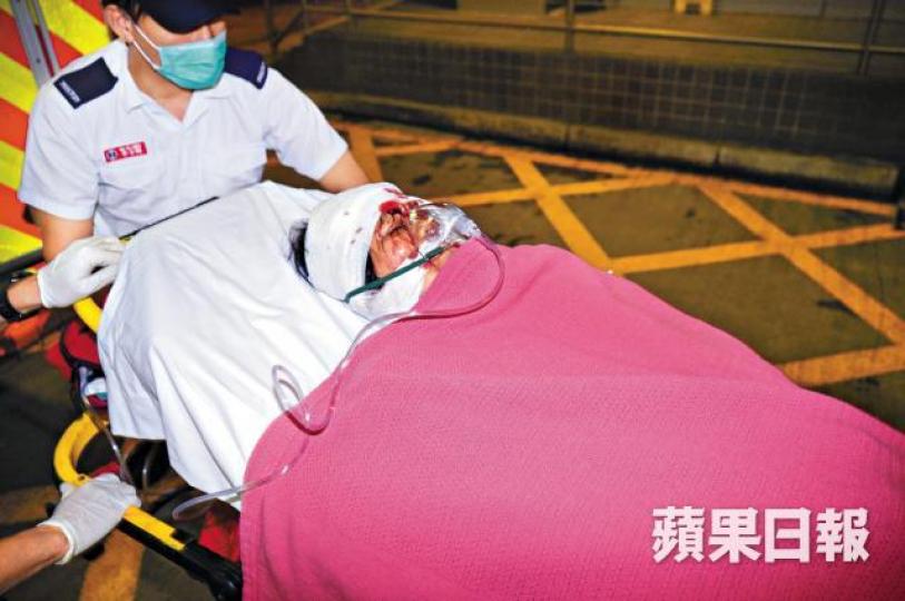 ■事主李艷葵當日頭部受傷經包紮後送院。資料圖片
■事主李艷葵當日頭部受傷經包紮後送院。資料圖片