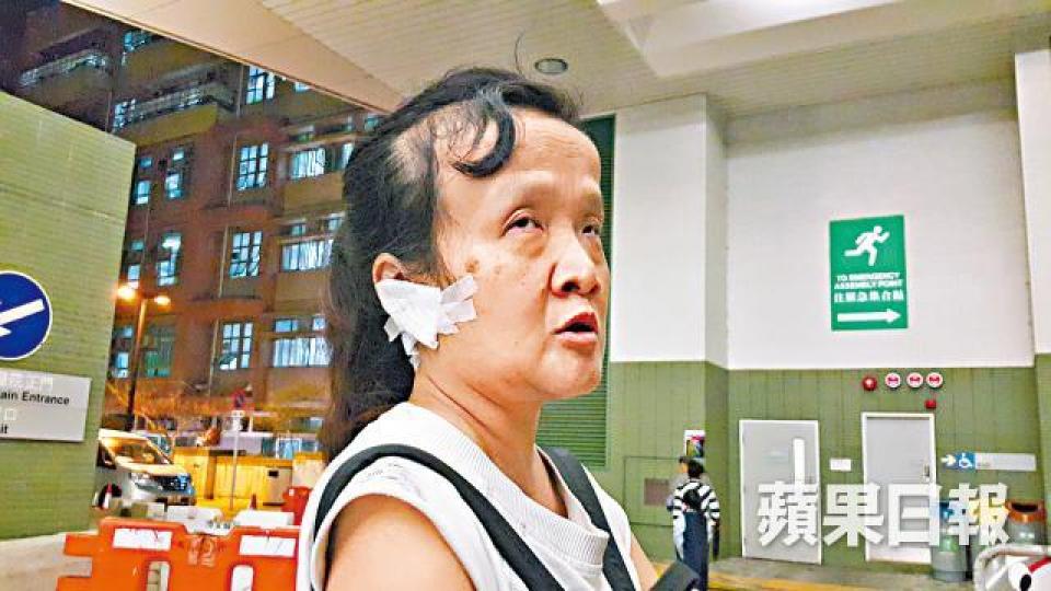 ■女事主遭氣槍射傷右耳後到醫院敷治。
■女事主遭氣槍射傷右耳後到醫院敷治。