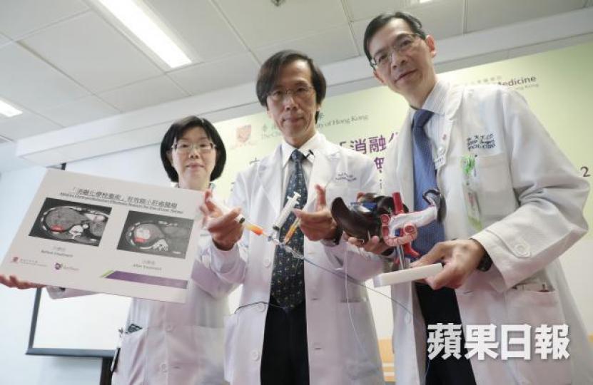 ■中大醫學院跨專科團隊成功研究新一代的經血管治療「消融化療栓塞術」。 ■中大醫學院跨專科團隊成功研究新一代的經血管治療「消融化療栓塞術」。