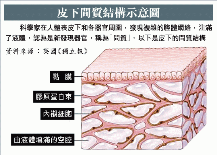 _e123_2sXE87_a1503a