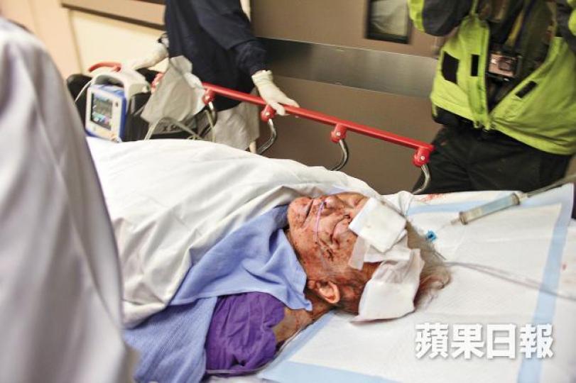 ■涉事老翁頭部被斬傷,送院治理後情況穩定。 ■涉事老翁頭部被斬傷,送院治理後情況穩定。