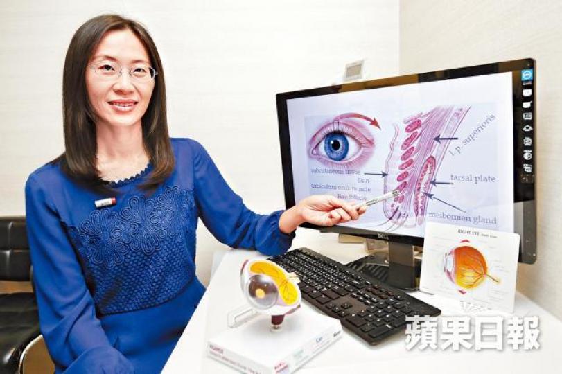 ■眼科醫生李琬微稱提瞼肌發育不良令眼瞼下垂。 ■眼科醫生李琬微稱提瞼肌發育不良令眼瞼下垂。