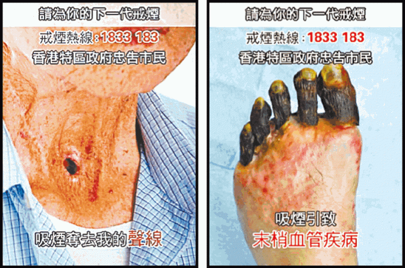■煙盒健康忠告圖像變得更逼真,如喉嚨穿窿(左圖)和爛腳趾(右圖)。 ■煙盒健康忠告圖像變得更逼真,如喉嚨穿窿(左圖)和爛腳趾(右圖)。