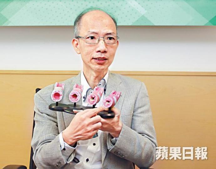 ■吳國強稱吸入式類固醇副作用少。