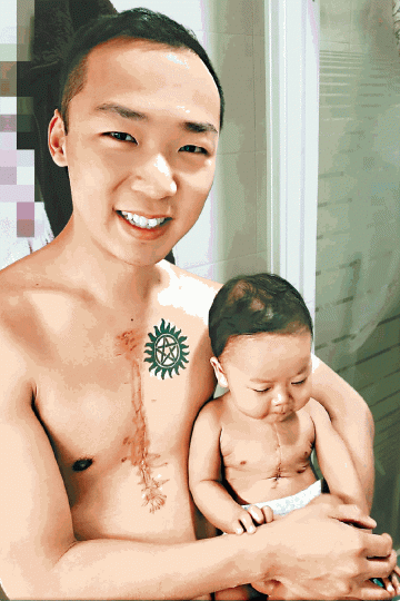 ■爸爸Jayco在自己胸口紋上與兒子相同的傷疤,「個仔條疤痕要孭住一世,我要教佢點面對」。受訪者提供圖片■只要兒子健康成長,Jayco與太太Doris再辛苦也感值得。胡智堅攝■兒子約3年後要再做手術,Jayco希望他屆時能完全康復。■小鐵漢一度被病折磨得瘦骨嶙峋,媽媽每日到醫院照顧。 ■爸爸Jayco在自己胸口紋上與兒子相同的傷疤,「個仔條疤痕要孭住一世,我要教佢點面對」。受訪者提供圖片■只要兒子健康成長,Jayco與太太Doris再辛苦也感值得。胡智堅攝■兒子約3年後要再做手術,Jayco希望他屆時能完全康復。■小鐵漢一度被病折磨得瘦骨嶙峋,媽媽每日到醫院照顧。