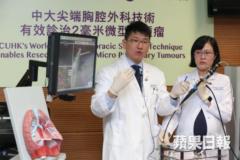 ■中大醫學院外科學系心胸外科組副教授吳士衡(左)及助理教授劉穎虹(右),示範用電磁導航支氣管鏡探測器實時偵測微形肺腫瘤。謝榮耀攝 ■中大醫學院外科學系心胸外科組副教授吳士衡(左)及助理教授劉穎虹(右),示範用電磁導航支氣管鏡探測器實時偵測微形肺腫瘤。謝榮耀攝