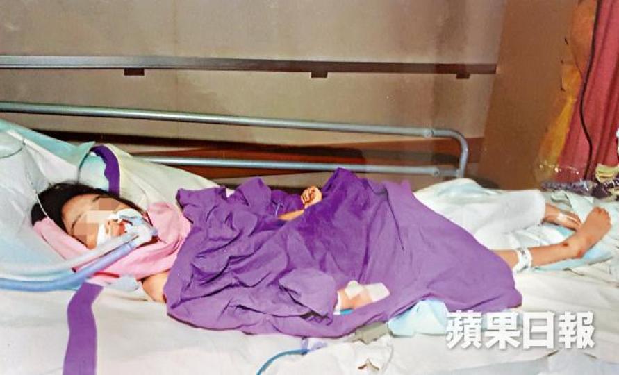 ■醫療報告指林林四肢癱瘓,大腦有組織流失,同類情況兒童都活不過20歲。資料圖片 ■醫療報告指林林四肢癱瘓,大腦有組織流失,同類情況兒童都活不過20歲。資料圖片