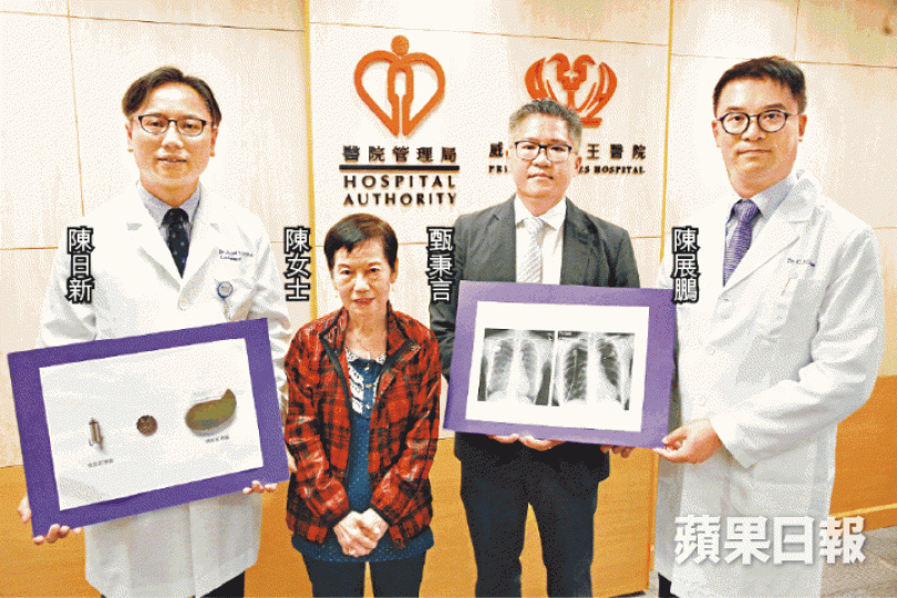 ■威院為超過170人植入無線起搏器,病人陳女士稱改用新儀器後再無細菌感染。何建忠攝 ■威院為超過170人植入無線起搏器,病人陳女士稱改用新儀器後再無細菌感染。何建忠攝