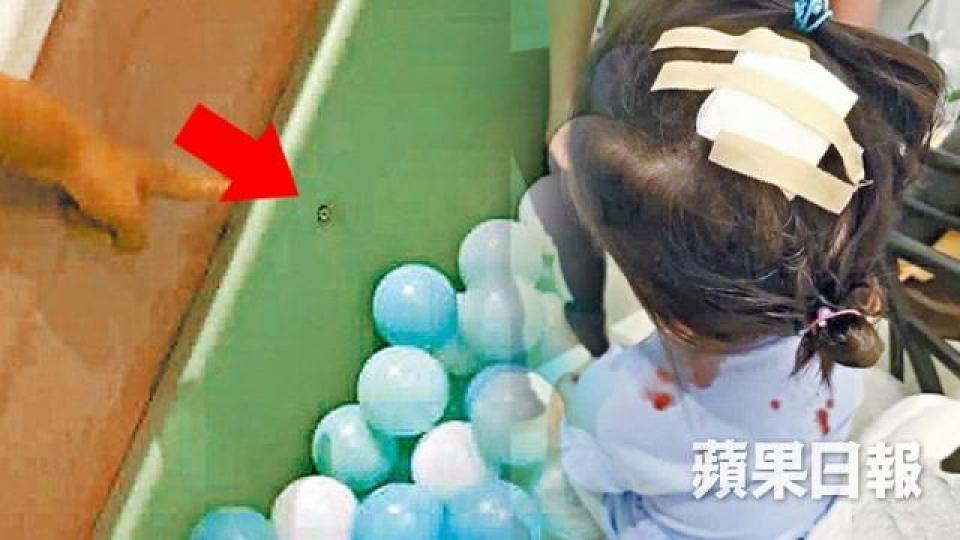 ■今年5月有3歲女童在觀塘室內兒童遊樂場波波池玩時,被池邊螺絲插傷頭致血流如注,遊樂場其後道歉及停業七天。資料圖片 ■今年5月有3歲女童在觀塘室內兒童遊樂場波波池玩時,被池邊螺絲插傷頭致血流如注,遊樂場其後道歉及停業七天。資料圖片
