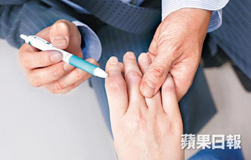 ■陳太的食指因之前病發導致關節腫脹。 ■陳太的食指因之前病發導致關節腫脹。