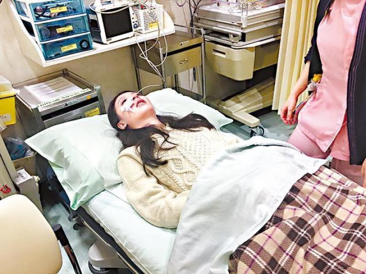 余香凝 鼻骨骨裂 余香凝 鼻骨骨裂