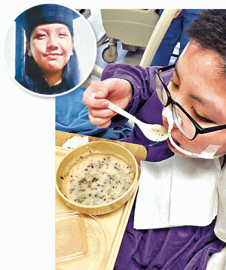 ■中風姓陳少女（圓圖）現已可進食粥及碎菜。家屬提供圖片■少女胞兄質疑聯院報告無誠意，將發信予醫管局提出質疑。