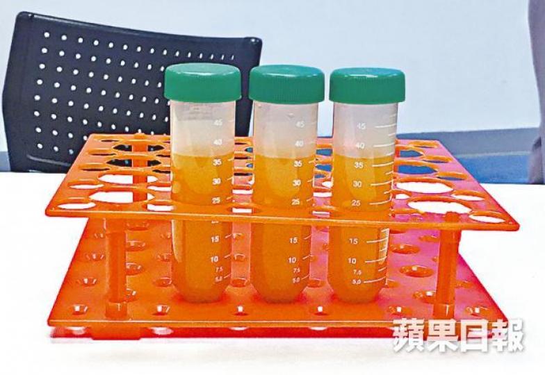 ■院方收集糞便樣本後,經優化和冷凍等程序,製成腸道微生物群製劑。 ■院方收集糞便樣本後,經優化和冷凍等程序,製成腸道微生物群製劑。