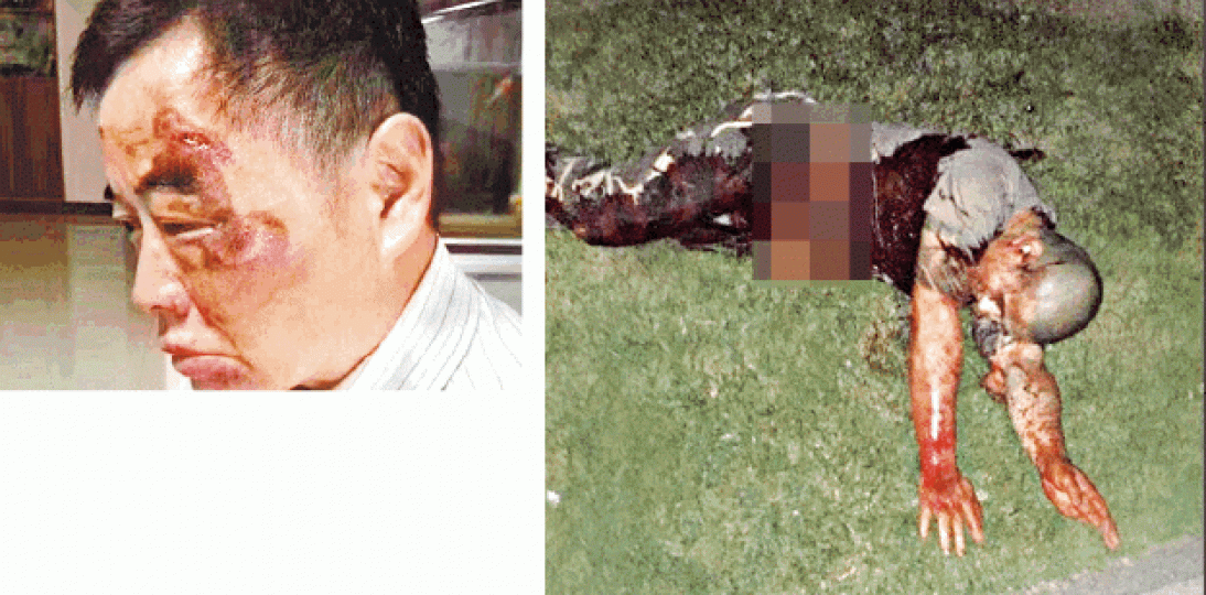 網傳于男臉部受傷照(左圖),劉海龍最終死在自己的刀下(右圖)。 網傳于男臉部受傷照(左圖),劉海龍最終死在自己的刀下(右圖)。
