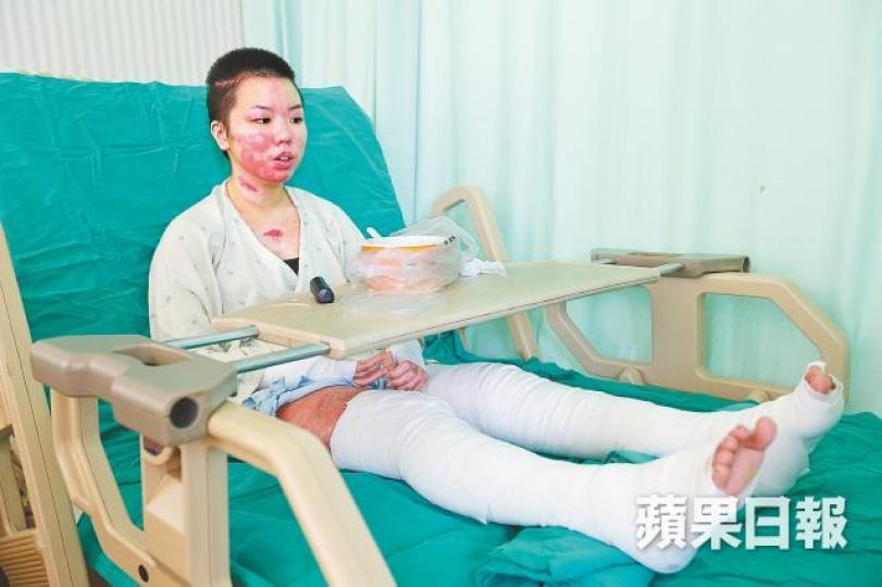 莫子青2015年台灣八仙水上樂園發生塵爆,大批傷者等待救援。 莫子青2015年台灣八仙水上樂園發生塵爆,大批傷者等待救援。